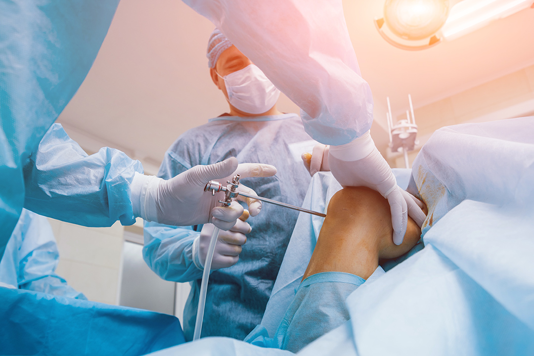 Everything You Need to Know About Knee Arthroscopy!