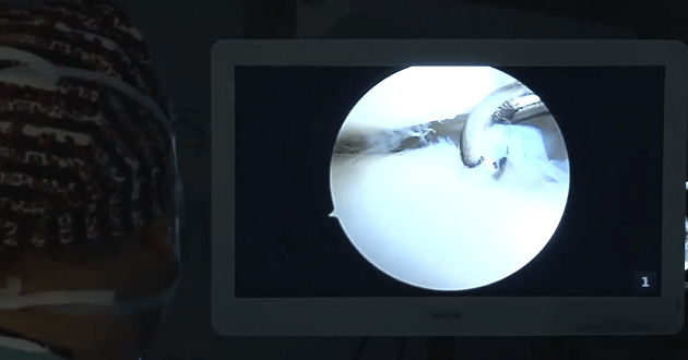 Ankle joint arthroscopy with Ass dr. Vladan Stevanović