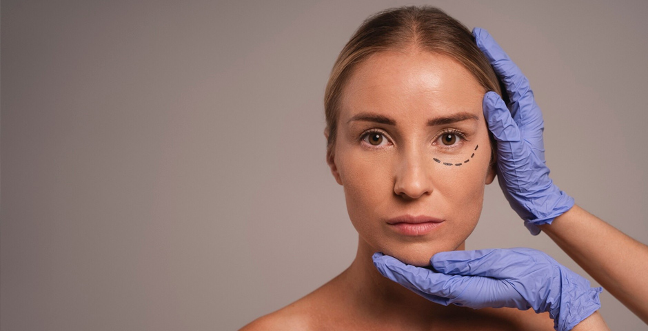 lice Eyelid surgery