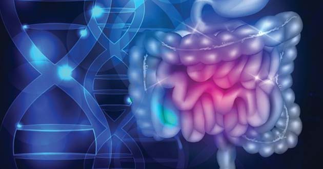 What is Crohn’s Disease?
