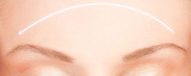 Podizanje obrva Eyebrow lift